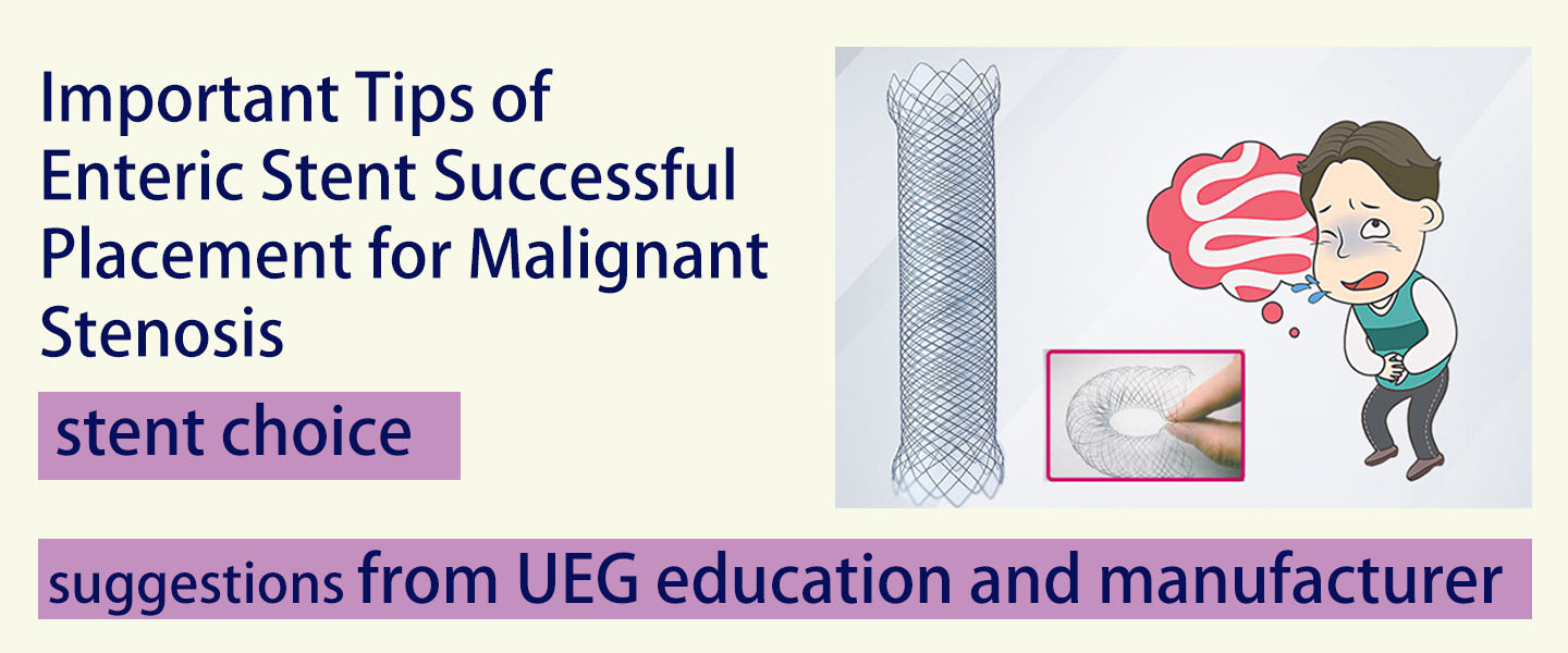 Important Tips of Enteric Stent Successful Placement for Malignant Stenosis